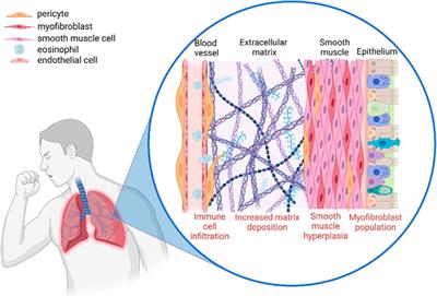 Pericytes: The lung-forgotten cell type